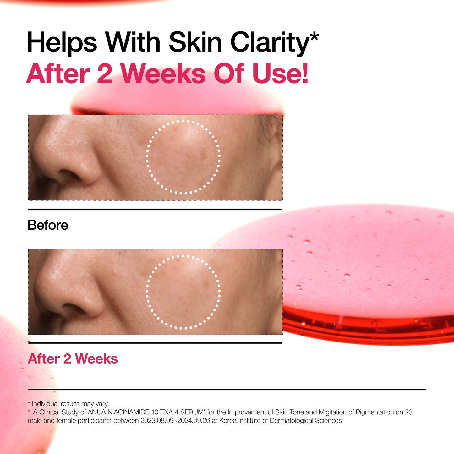 ANUA - Niacinamide 10% + TXA 4% Serum 30 ML | Suero Antimanchas